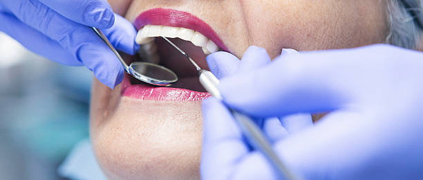 Best Emergency Dentist for Knocked-Out Tooth in La Porte, IN